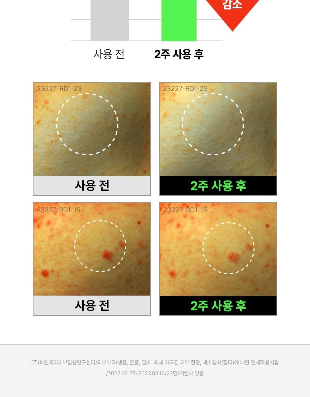 2週美背消痘~韓國 FATION Nosca9 Trouble Body Mist 抗痘去粒粒身體噴霧 - 145ml