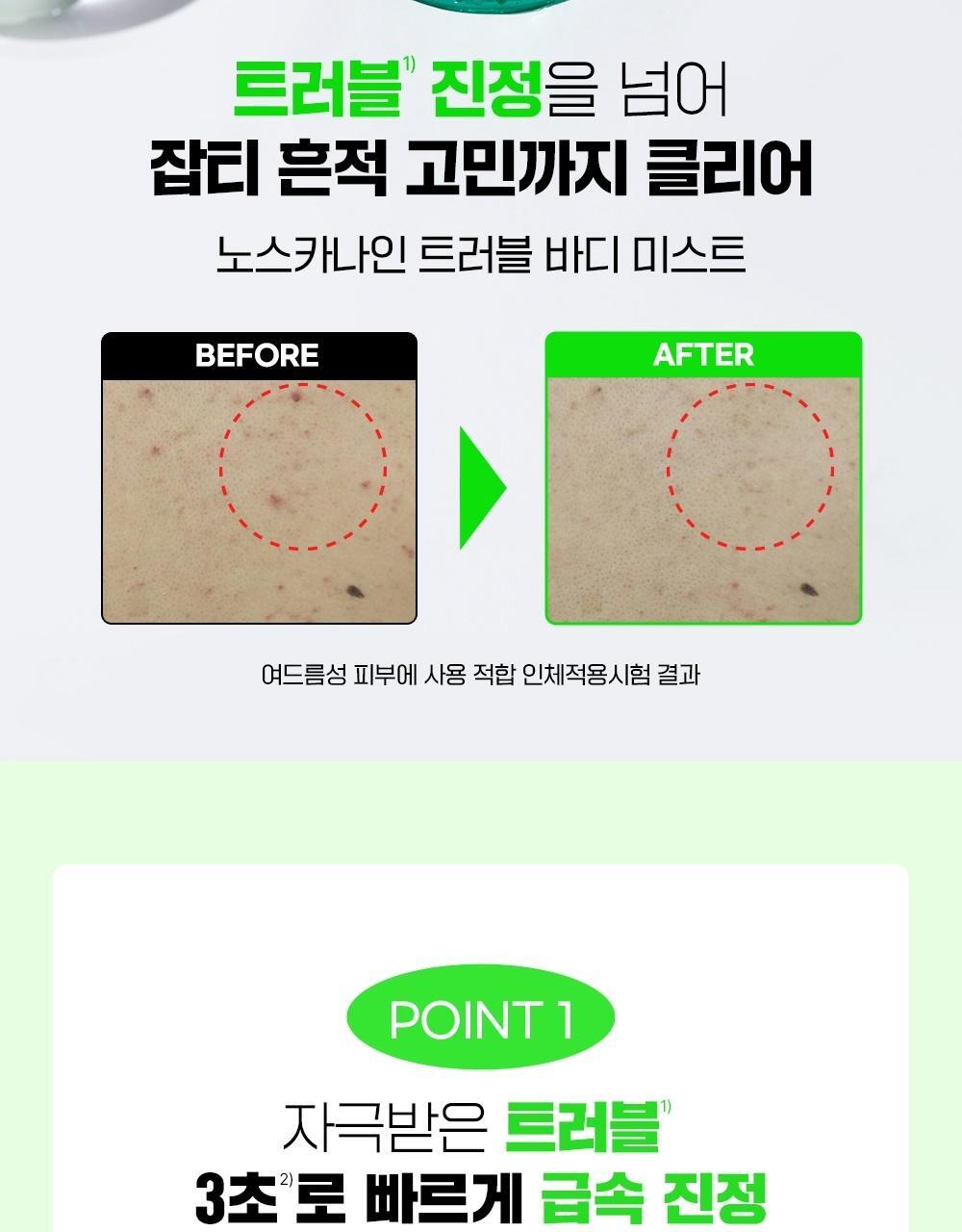 2週美背消痘~韓國 FATION Nosca9 Trouble Body Mist 抗痘去粒粒身體噴霧 - 145ml