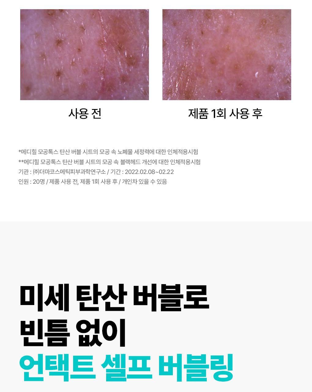 韓國 Mediheal Mogongtox Soda Bubble Sheet 碳酸泡泡毛孔排毒深清黑碳面膜 10片裝 - 2種選擇