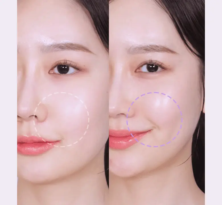 撫平法令紋 提拉蘋果肌【送膠原蛋白噴霧】~韓國 BioHeal BOH Probioderm Melting Collagen Deep Shot Nasolabial Folds & Cheek Film 納米級96.8%高濃度純膠原蛋白微針回彈提拉法令紋前頰膜- 5片裝