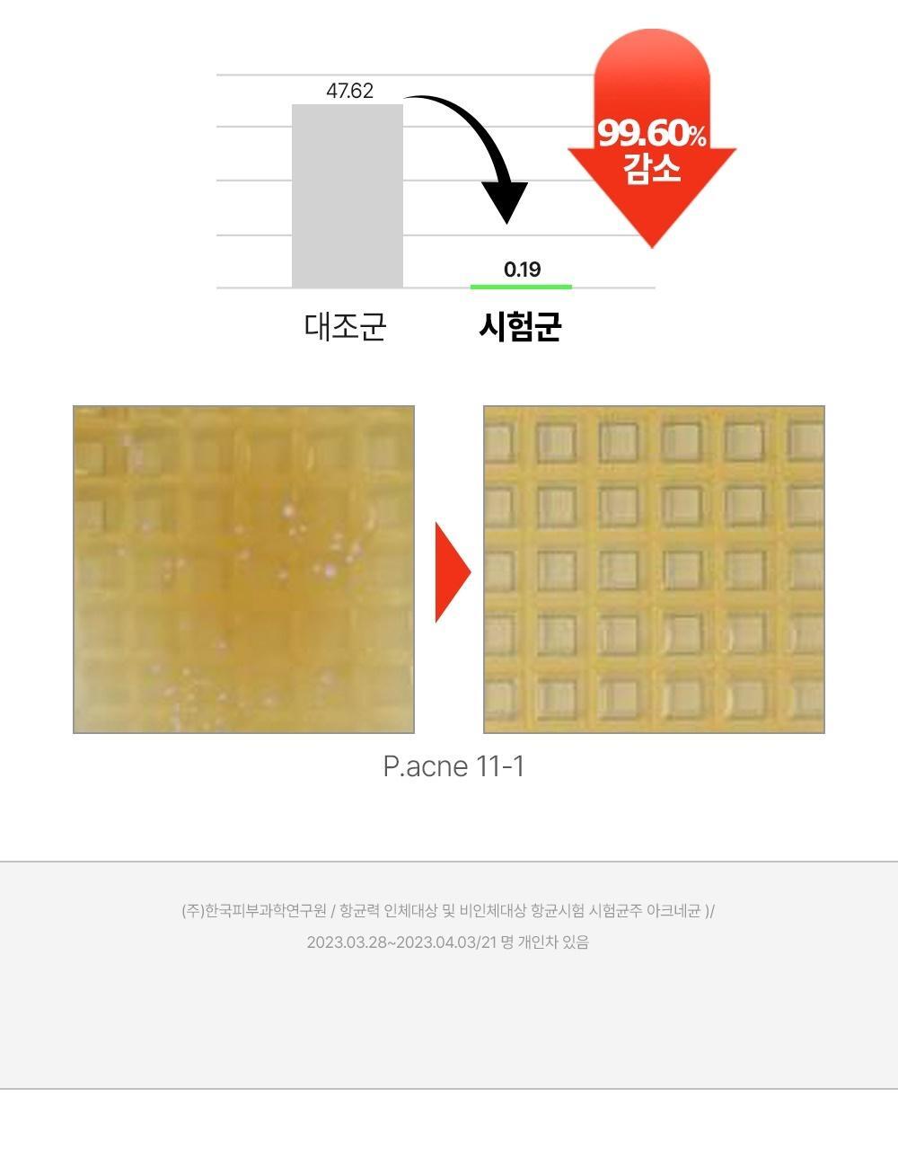 韓國東亞藥廠出品~去身體暗瘡粉刺~FATION Nosca9 Trouble Body Wash 淨痘去粒粒沐浴露 - 490ml