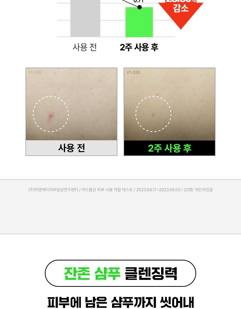 韓國東亞藥廠出品~去身體暗瘡粉刺~FATION Nosca9 Trouble Body Wash 淨痘去粒粒沐浴露 - 490ml