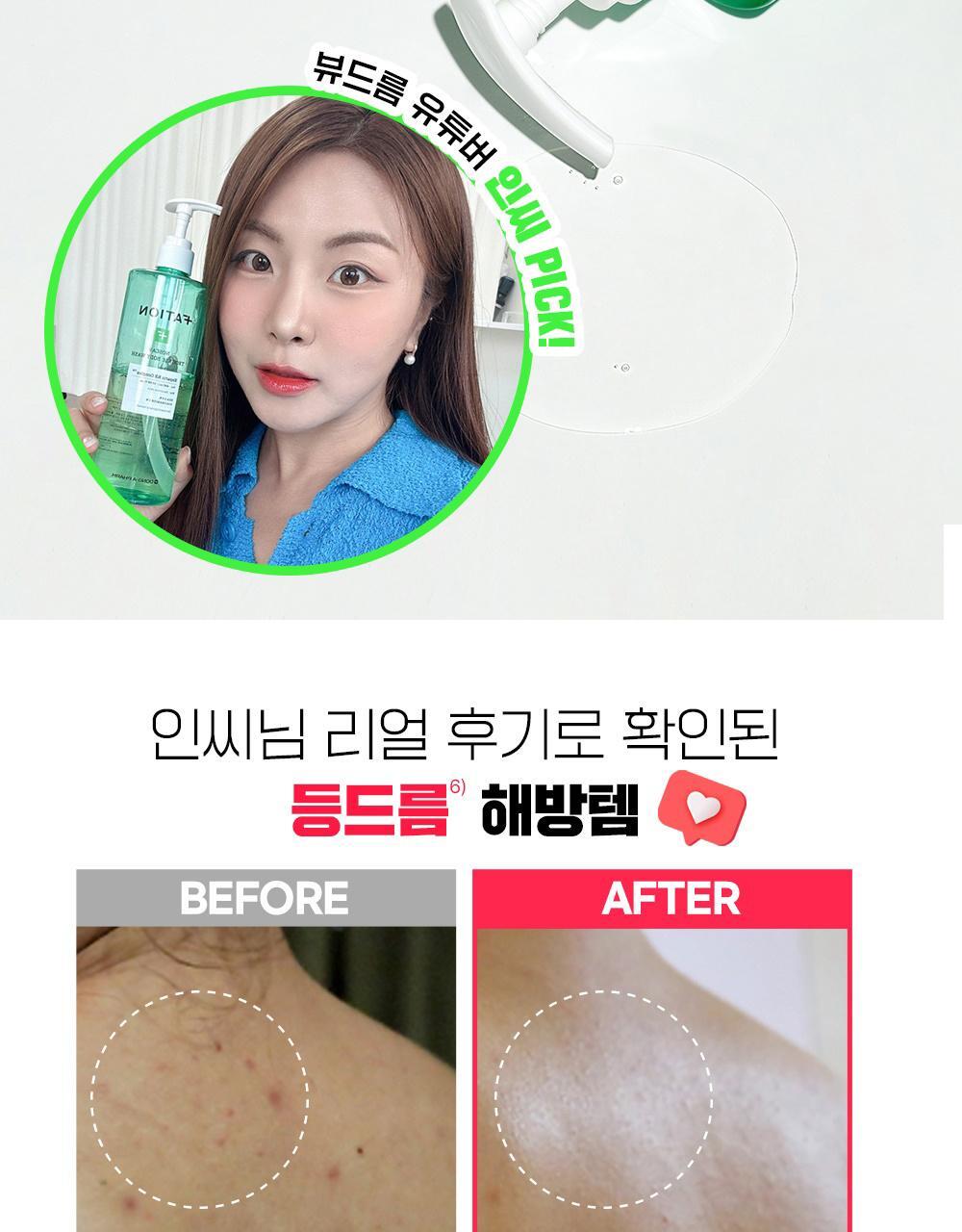 韓國東亞藥廠出品~去身體暗瘡粉刺~FATION Nosca9 Trouble Body Wash 淨痘去粒粒沐浴露 - 490ml