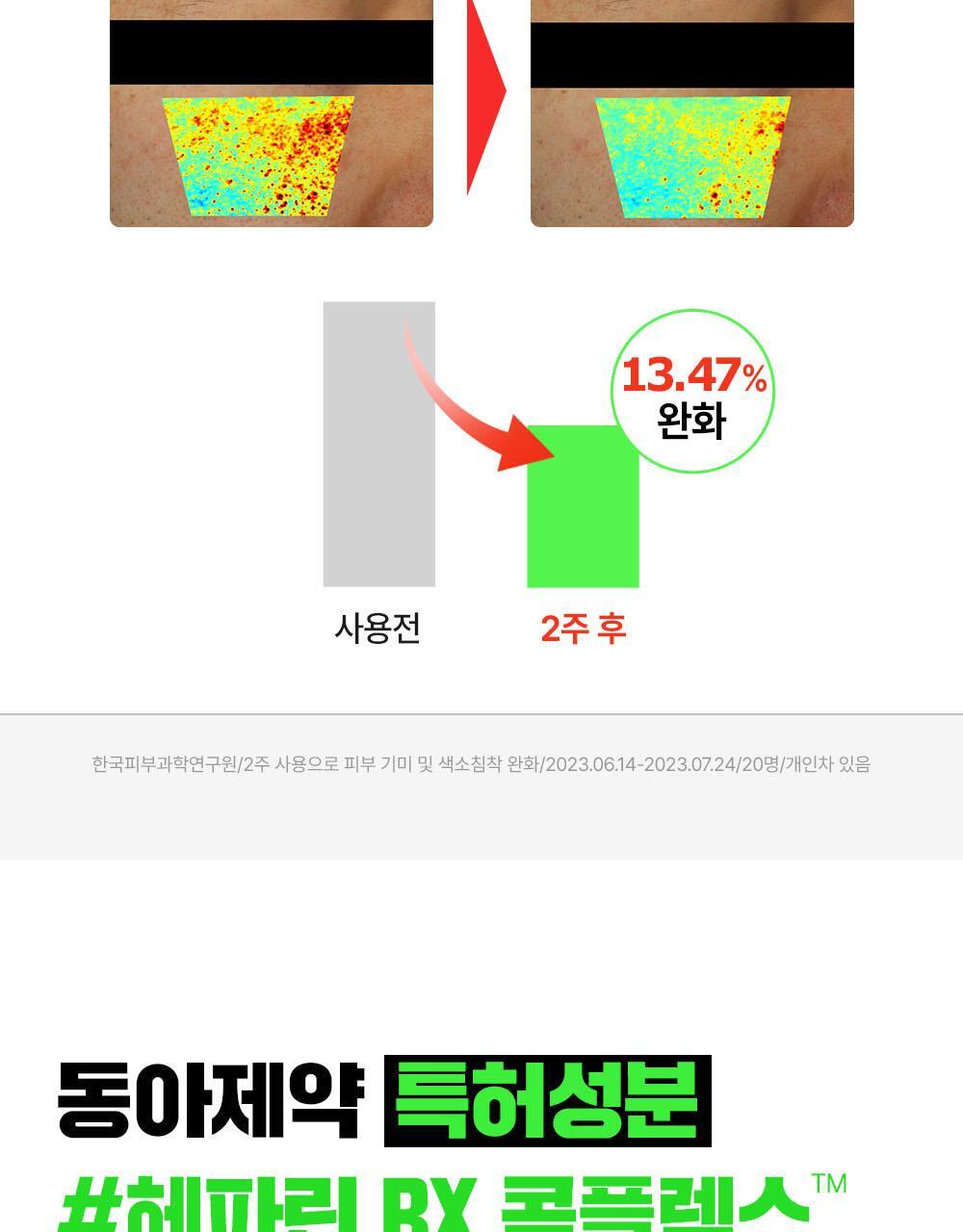 一滴奇蹟安瓶 7天去印去斑瑕疵~韓國 Fation Nosca9 Trouble Toning Ampoule 去痘印提亮安瓶 -15ml