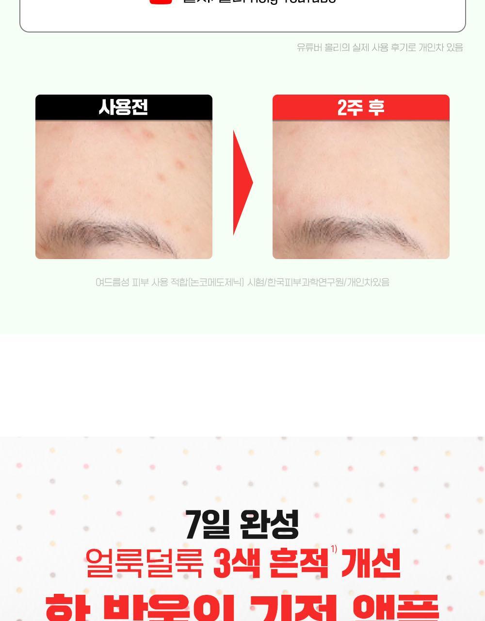 一滴奇蹟安瓶 7天去印去斑瑕疵~韓國 Fation Nosca9 Trouble Toning Ampoule 去痘印提亮安瓶 -15ml