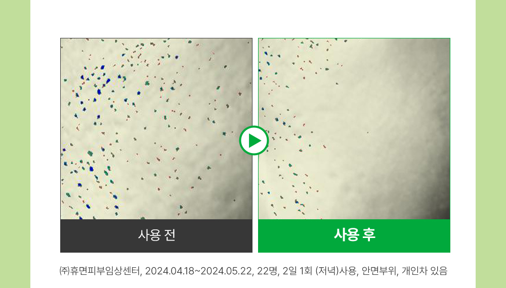 收毛孔平滑凹凸感~韓國Sungboon Editor Green Tomato Pore Boosting Deep Shot Ampoule  綠番茄增強微針高效緊緻收毛孔安瓶精華