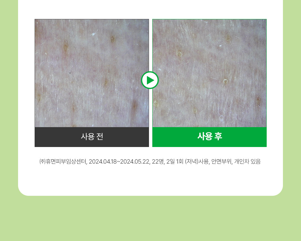 收毛孔平滑凹凸感~韓國Sungboon Editor Green Tomato Pore Boosting Deep Shot Ampoule  綠番茄增強微針高效緊緻收毛孔安瓶精華