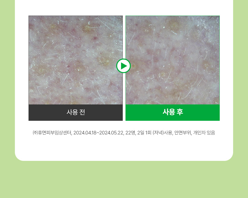 收毛孔平滑凹凸感~韓國Sungboon Editor Green Tomato Pore Boosting Deep Shot Ampoule  綠番茄增強微針高效緊緻收毛孔安瓶精華