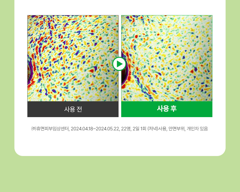 收毛孔平滑凹凸感~韓國Sungboon Editor Green Tomato Pore Boosting Deep Shot Ampoule  綠番茄增強微針高效緊緻收毛孔安瓶精華