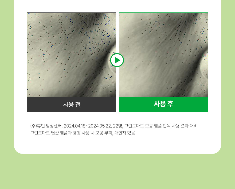 收毛孔平滑凹凸感~韓國Sungboon Editor Green Tomato Pore Boosting Deep Shot Ampoule  綠番茄增強微針高效緊緻收毛孔安瓶精華