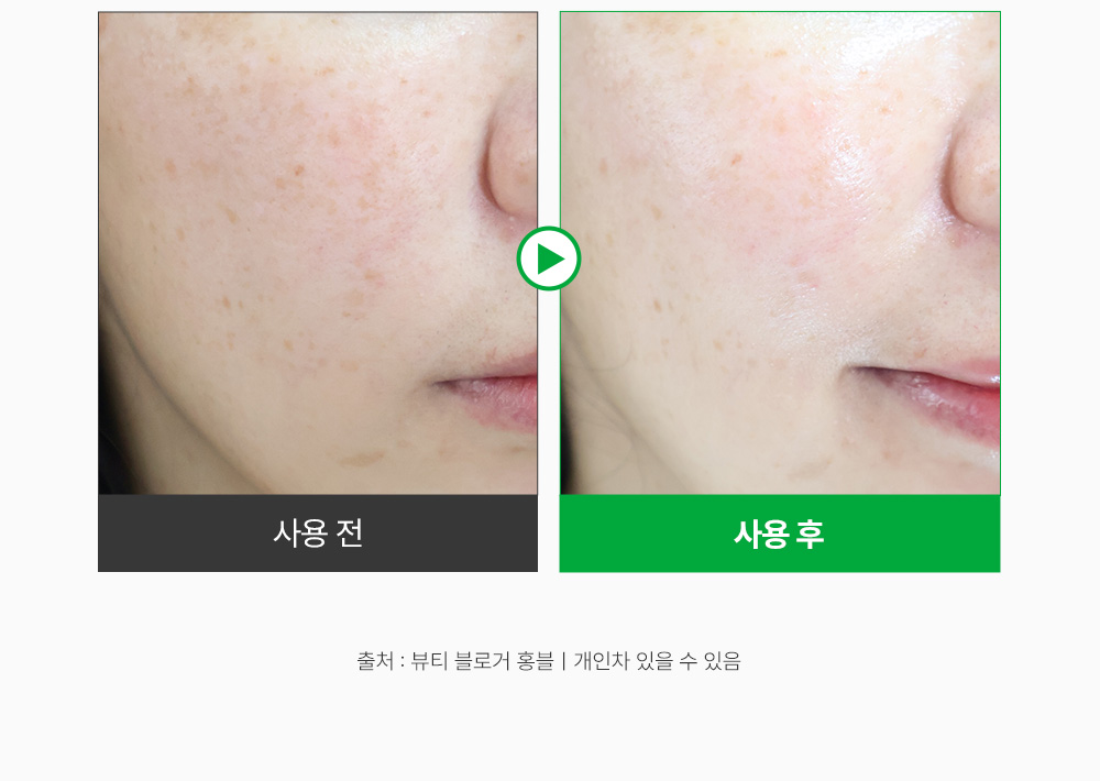 收毛孔平滑凹凸感~韓國Sungboon Editor Green Tomato Pore Boosting Deep Shot Ampoule  綠番茄增強微針高效緊緻收毛孔安瓶精華