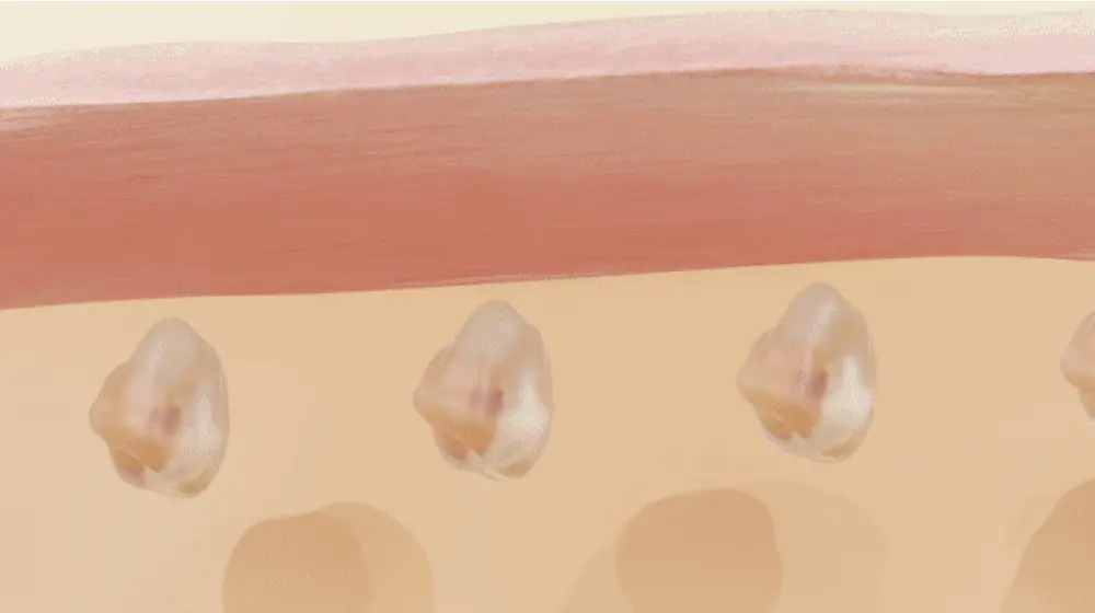 收毛孔平滑凹凸感~韓國Sungboon Editor Green Tomato Pore Boosting Deep Shot Ampoule  綠番茄增強微針高效緊緻收毛孔安瓶精華