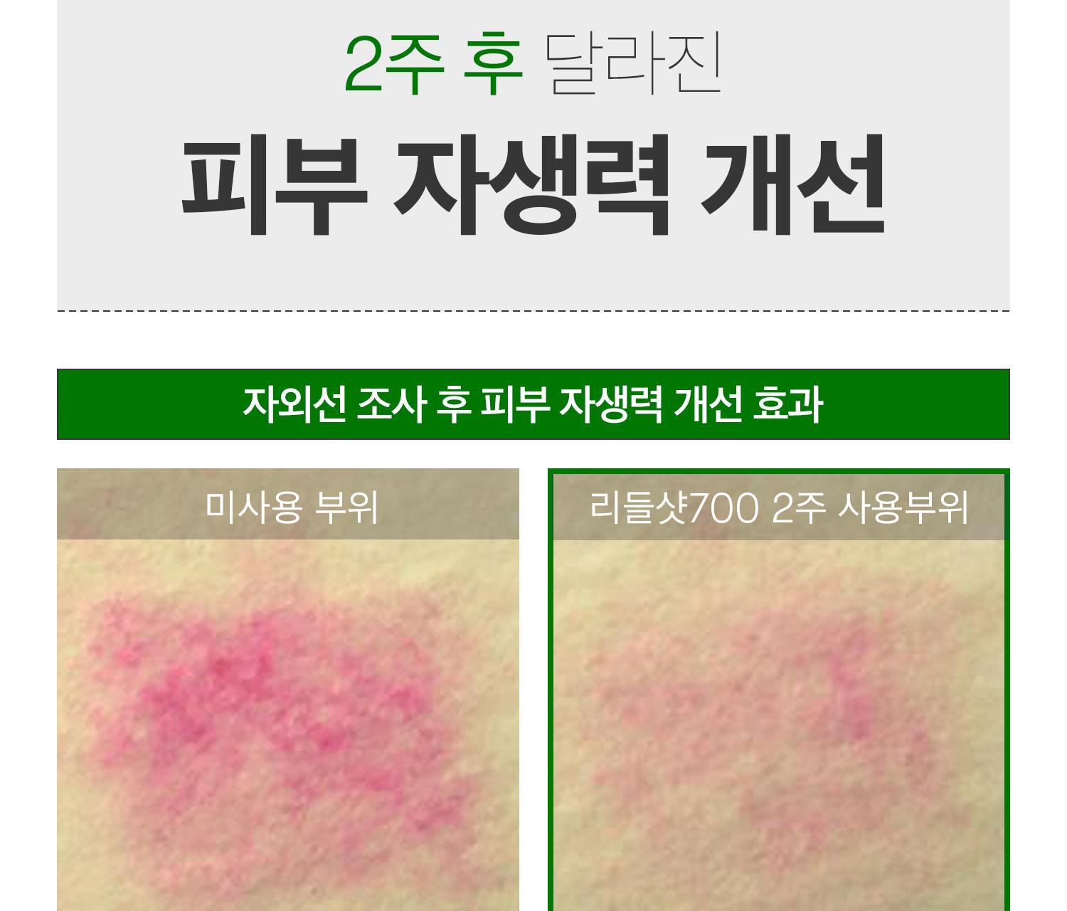 2週重煥肌膚再生~韓國 VT Reedle Shot 700 積雪草塗抹式微針700導入精華 - 30ml