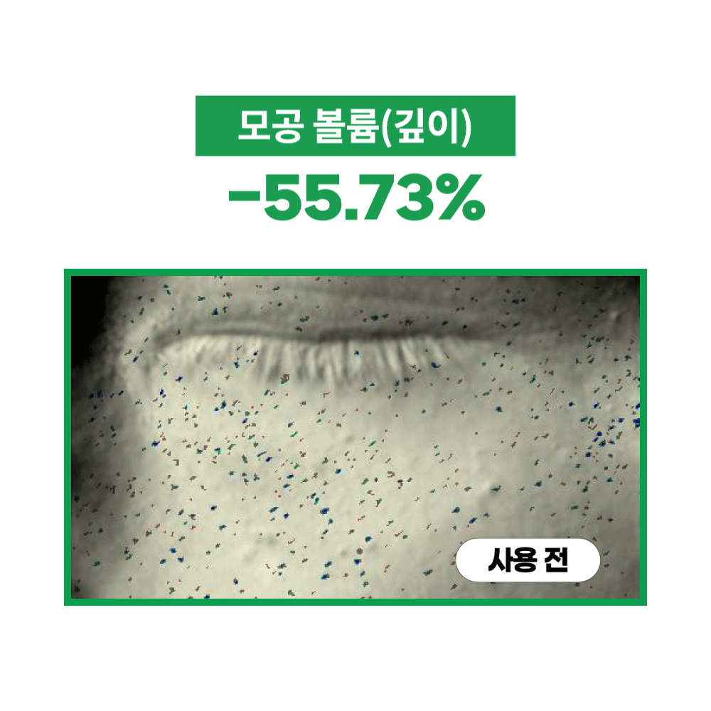 韓國熱賣No.1面霜～S.NATURE Aqua Squalane Moisturizing Cream 角鯊烷保濕面霜 - 大容量80ml