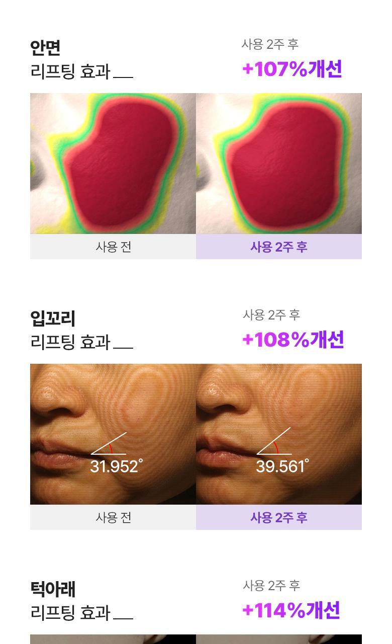 醫美級無痛緊緻提拉!韓國 BioHeal BOH X Oligio Probioderm 3D Lifting Full Face Tension Gel Mask 益生菌3D全面提拉抗老彈力凝膠面膜