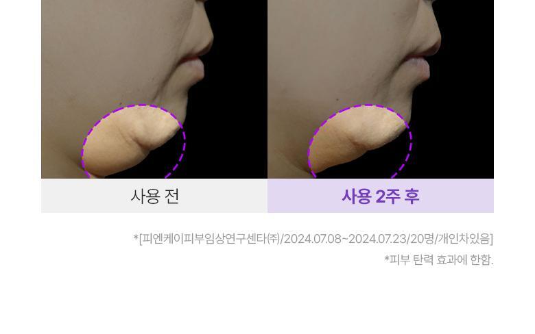 醫美級無痛緊緻提拉!韓國 BioHeal BOH X Oligio Probioderm 3D Lifting Full Face Tension Gel Mask 益生菌3D全面提拉抗老彈力凝膠面膜