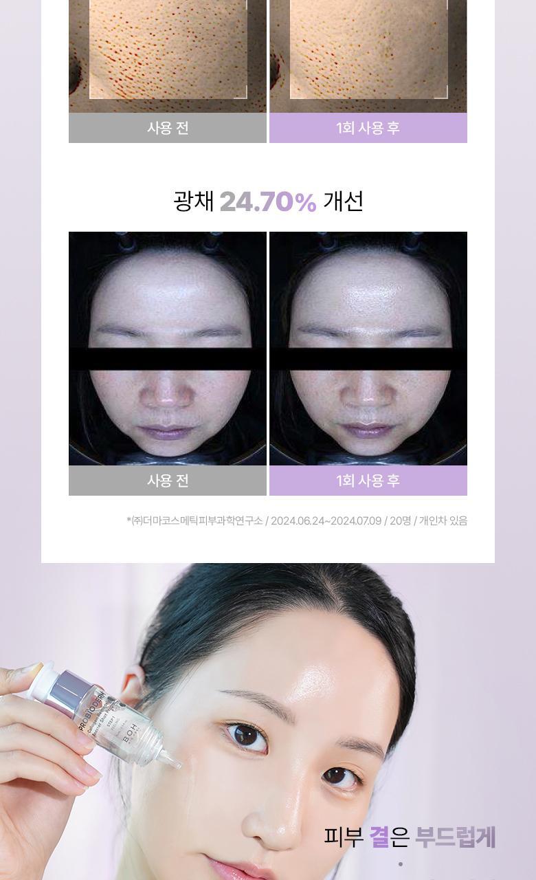 緊緻收毛孔療程~韓國 Bio Heal Boh Probioderm Collagen Remodeling Booster Shot Program 益生菌膠原蛋白微針導入+PDRN水光緊緻2步精華 - 2件套裝