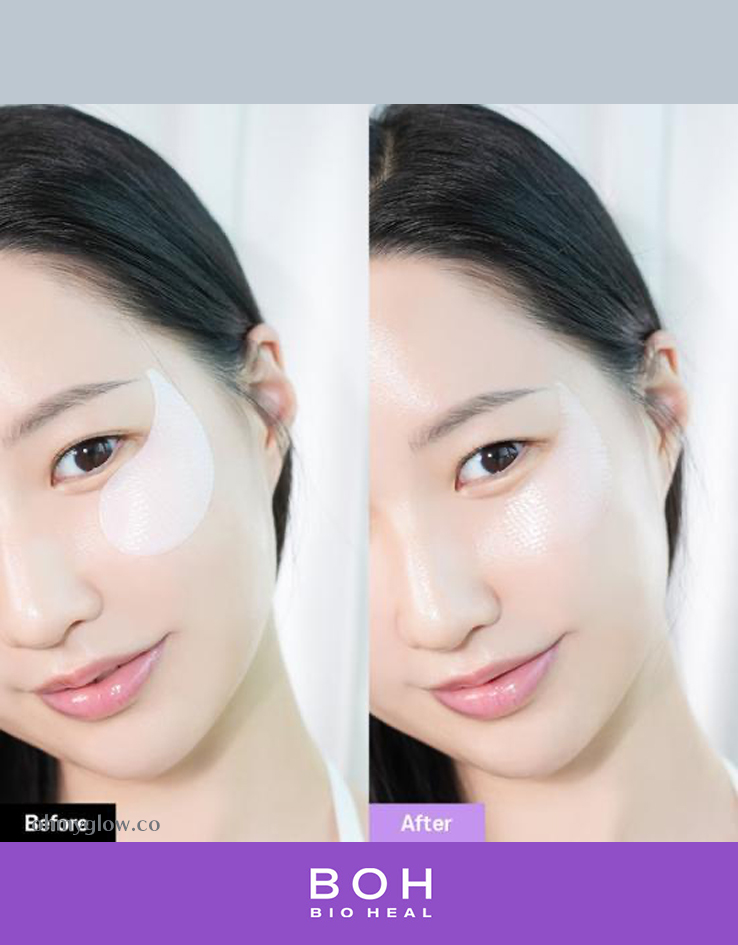改善眼周5大問題～韓國 Bio Heal Boh Probioderm Collagen Remodeling Eye Patch 益生菌膠原蛋白PDRN緊緻淡紋果凍眼膜 - 60片裝