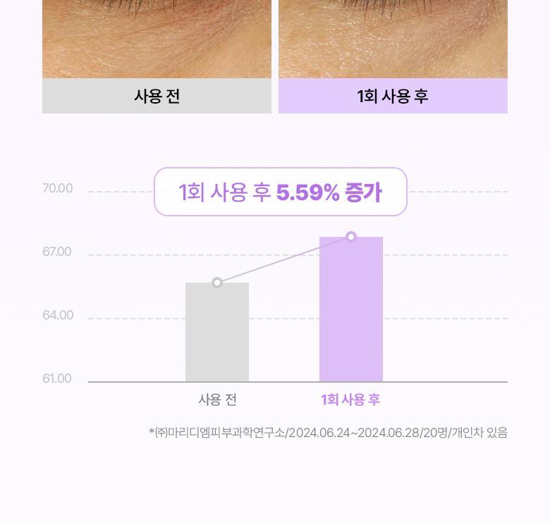 改善眼周5大問題~韓國 Bio Heal Boh Probioderm Collagen Remodeling Eye Patch 益生菌膠原蛋白PDRN緊緻淡紋果凍眼膜 - 60片裝
