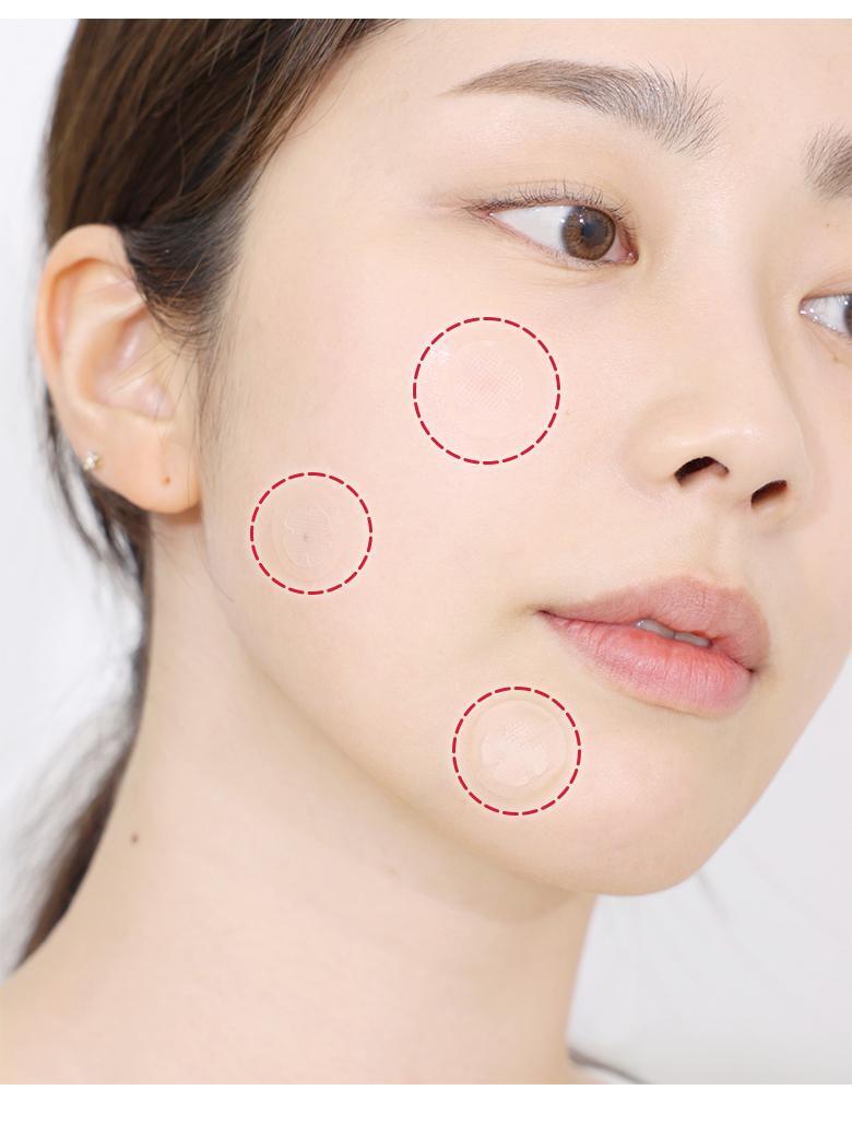 【2件額外9折】韓國Olive Young 痘痘貼！Care Plus Salicylic Acid Trouble Patch 水楊酸痘痘暗瘡貼 - 12片裝