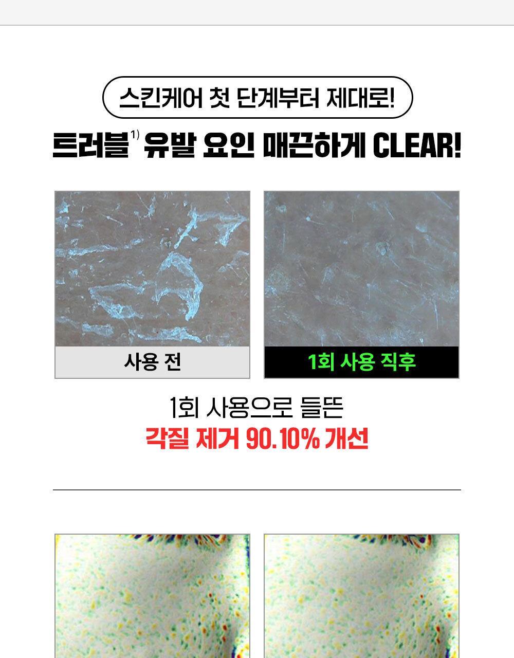 韓國東亞藥廠 FATION Nosca9 Trouble Clear Toner 淨痘鎮靜爽膚水 - 200ml