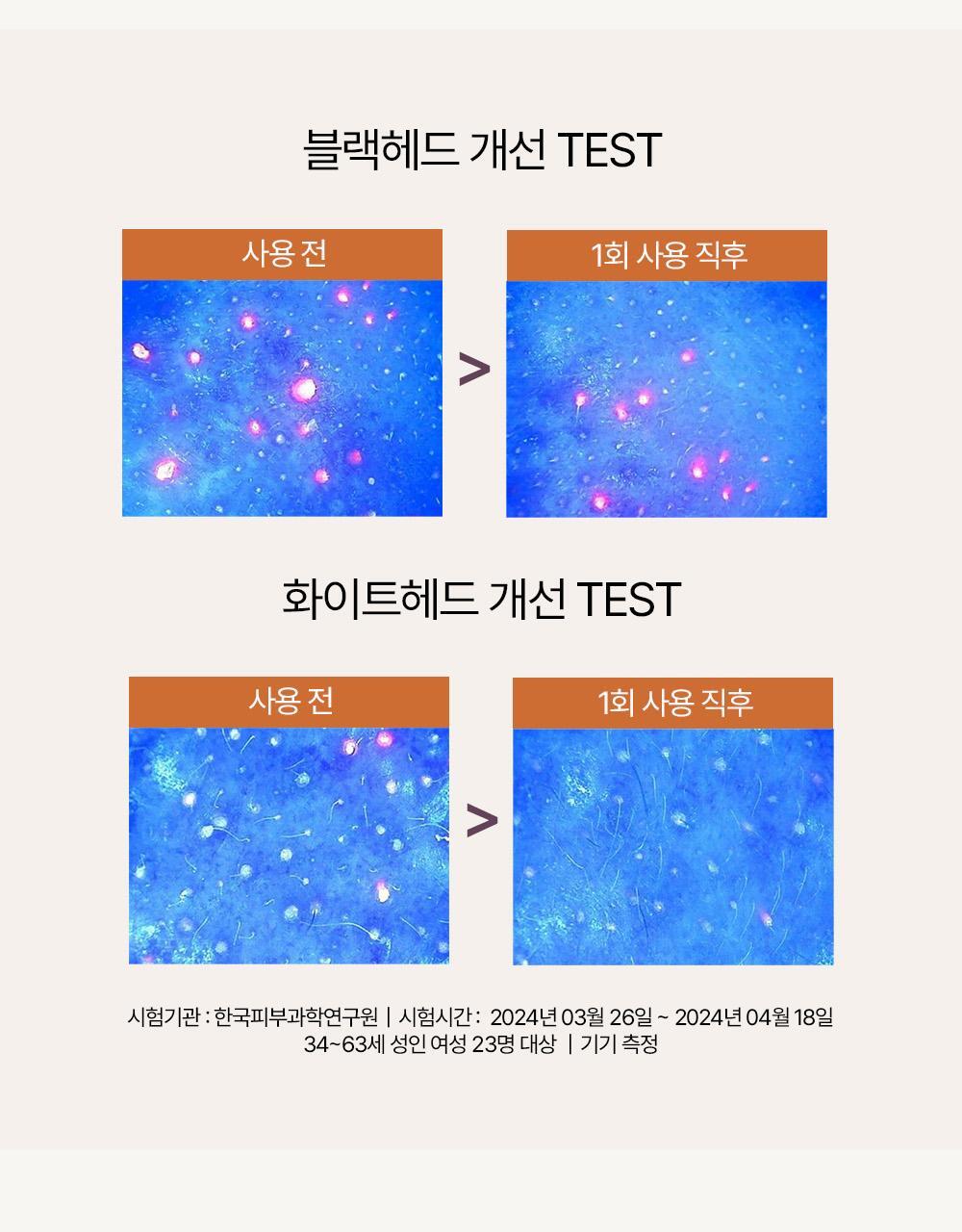 卸妝同時清黑頭～韓國 HEVEBLUE Salmon Caring Centella Llight Cleansing Oil 三文魚子PDRN積雪草輕盈清黑頭卸妝油 - 250ml