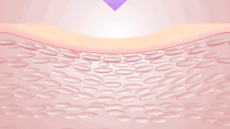 KO毛孔鬆弛下垂~韓國 BioHeal Boh Probioderm Collagen Remodeling Cream 第2代 益生菌膠原蛋白多胜肽重塑緊緻毛孔矯正膠囊面霜 50ml