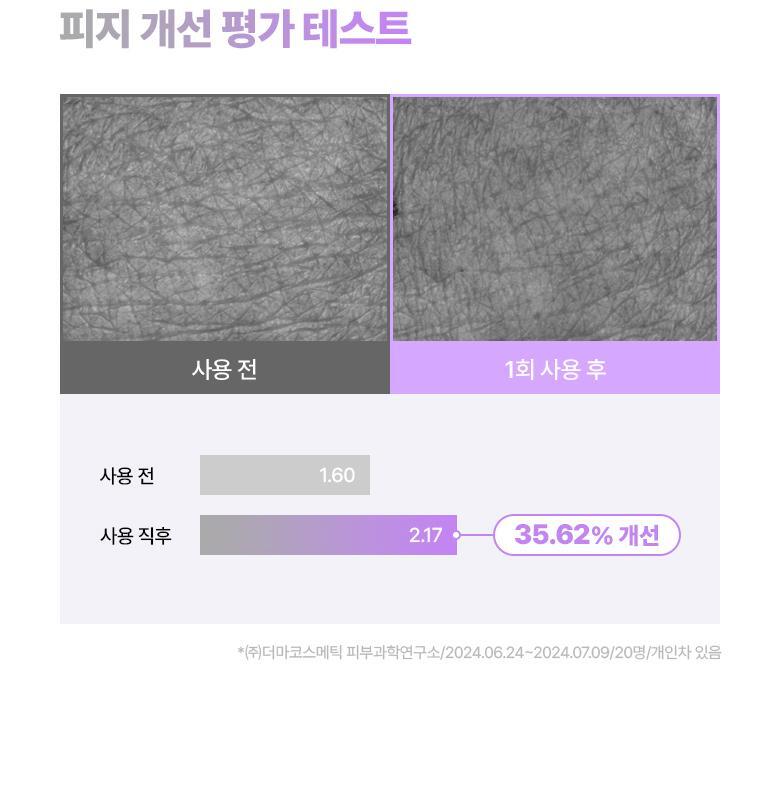 家用微針收毛孔!韓國 BioHeal Boh Probioderm Collagen Remodeling Deep Shot Serum 益生菌膠原蛋白重塑緊緻收毛孔PDRN微針精華 30ml