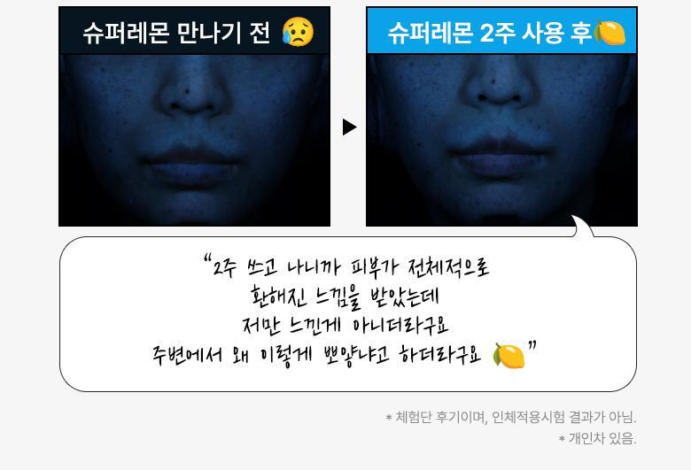 【送夜間維他命活化劑 】韓國 Bring Green Super Lemon Glutathione Brightening Serum 50ml (+Night Activator 3g) 🍋高濃度超級檸檬穀胱甘肽美白淡斑精華