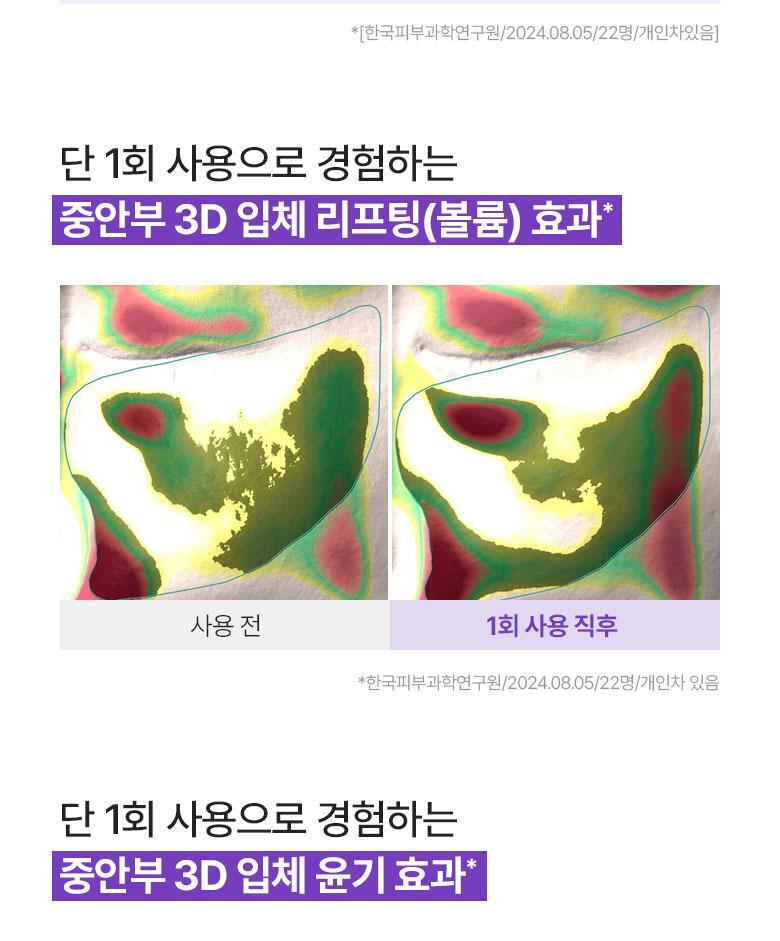 韓國黑科技 醫美級無痛緊緻提拉!BioHeal BOH x Oligio Probioderm 3D Lifting Voluming Patch 益生菌3D提拉抗老高彈性凝膠面頰面膜 4+1P - 5片裝