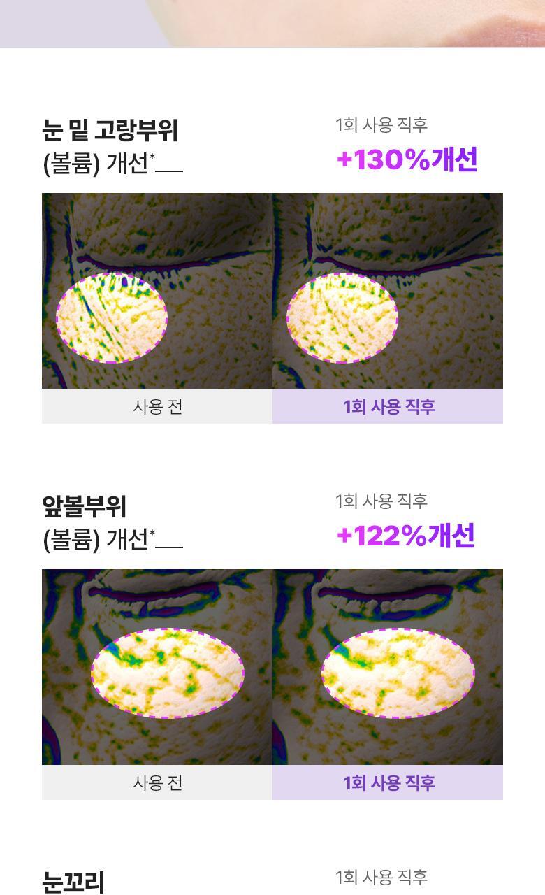 韓國黑科技 醫美級無痛緊緻提拉!BioHeal BOH x Oligio Probioderm 3D Lifting Voluming Patch 益生菌3D提拉抗老高彈性凝膠面頰面膜 4+1P - 5片裝