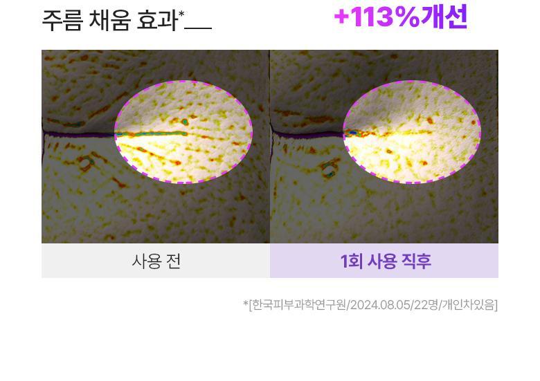 韓國黑科技 醫美級無痛緊緻提拉!BioHeal BOH x Oligio Probioderm 3D Lifting Voluming Patch 益生菌3D提拉抗老高彈性凝膠面頰面膜 4+1P - 5片裝