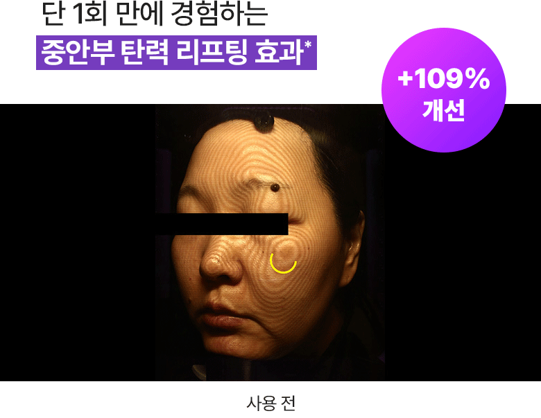 韓國黑科技 醫美級無痛緊緻提拉!BioHeal BOH x Oligio Probioderm 3D Lifting Voluming Patch 益生菌3D提拉抗老高彈性凝膠面頰面膜 4+1P - 5片裝