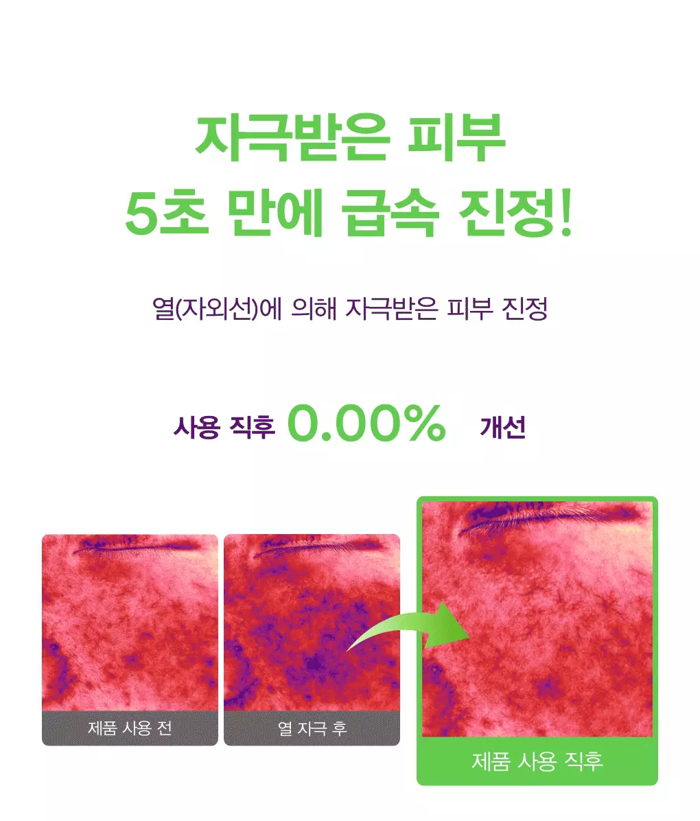 5秒舒緩減紅消炎 改善痘痘～韓國 ABIB Heartleaf TECA Capsule Serum Calming Drop 💚魚腥草TECA積雪草膠囊舒緩修護精華液 50ml