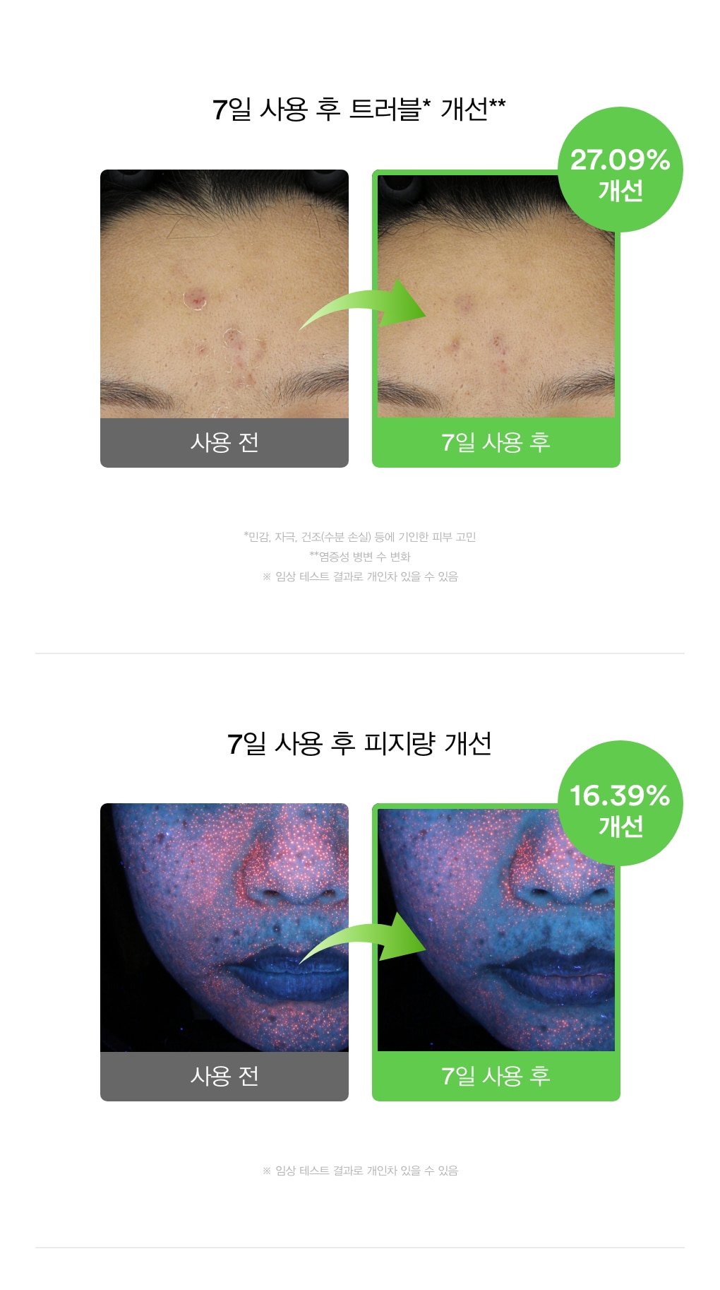5秒舒緩減紅消炎 改善痘痘～韓國 ABIB Heartleaf TECA Capsule Serum Calming Drop 💚魚腥草TECA積雪草膠囊舒緩修護精華液 50ml