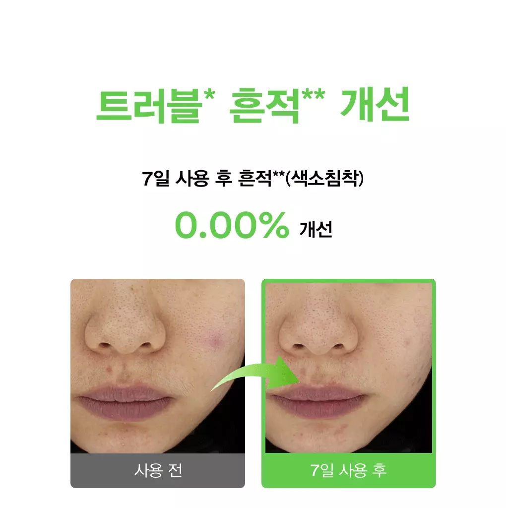 5秒舒緩減紅消炎 改善痘痘～韓國 ABIB Heartleaf TECA Capsule Serum Calming Drop 💚魚腥草TECA積雪草膠囊舒緩修護精華液 50ml