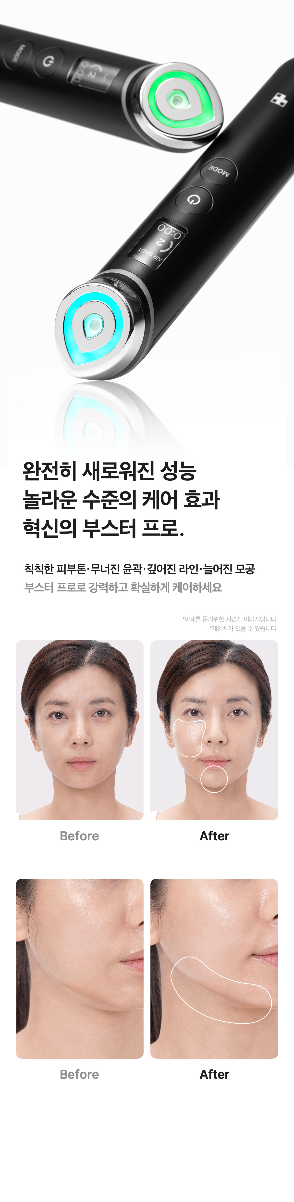 下單照價93折! 韓國No.1美容儀！Medicube Age-R Booster Pro 智慧6in1多功能美容儀 - 黑色