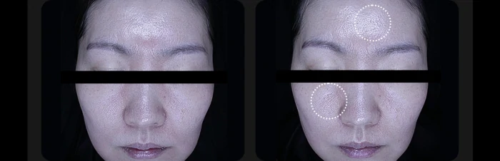 下單照價93折! 韓國No.1美容儀！Medicube Age-R Booster Pro 智慧6in1多功能美容儀 - 黑色