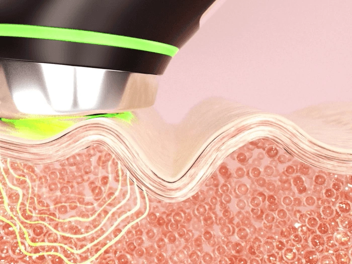 下單照價93折! 韓國No.1美容儀！Medicube Age-R Booster Pro 智慧6in1多功能美容儀 - 黑色