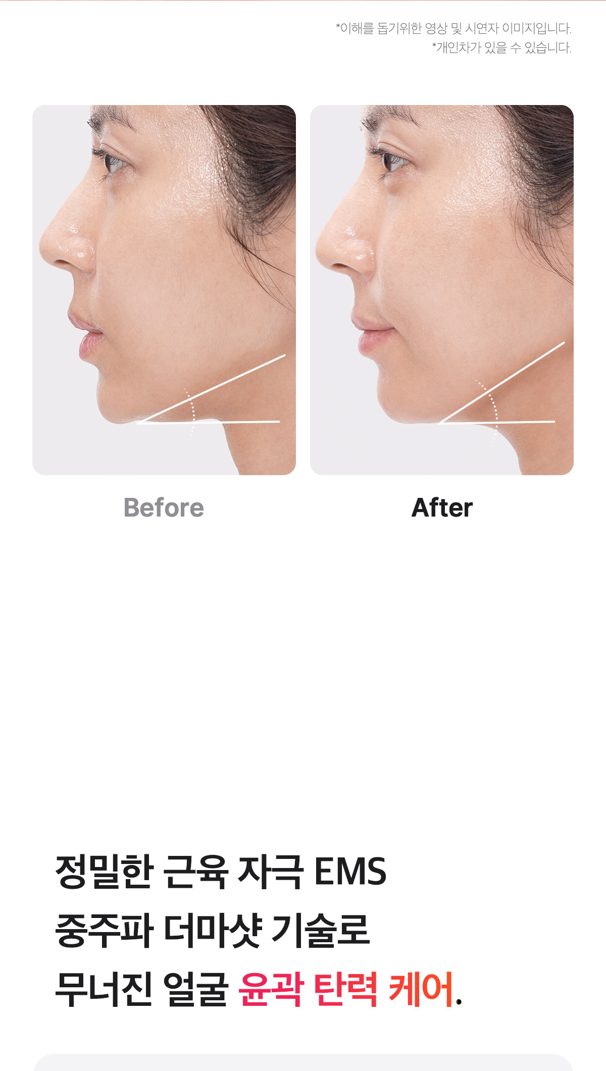 下單照價93折! 韓國No.1美容儀！Medicube Age-R Booster Pro 智慧6in1多功能美容儀 - 黑色