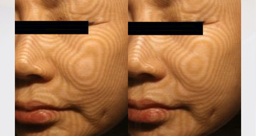 即時改善粗大毛孔～韓國 AROCELL BOTULCARE MASK EX 肉毒桿菌胜肽收毛孔去浮腫膠原蛋白果凍面膜4片裝 - 2種選擇