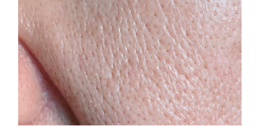 即時改善粗大毛孔～韓國 AROCELL BOTULCARE MASK EX 肉毒桿菌胜肽收毛孔去浮腫膠原蛋白果凍面膜4片裝 - 2種選擇