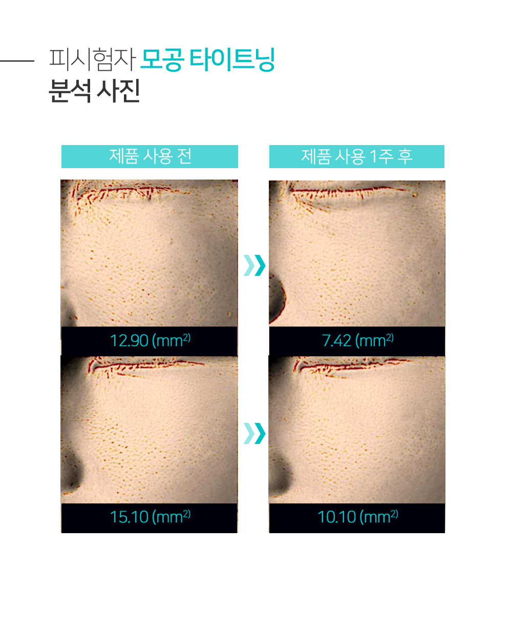 ＼1+1套裝／卸妝x潔面x溶解黑頭3合1 韓國 SHHOM White Vegan Cleansing Balm 溫和卸妝潔面膏 - 2種選擇