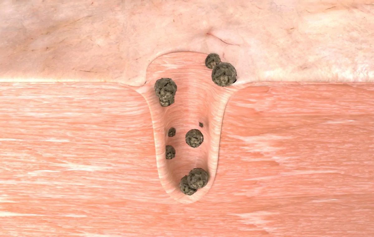 韓國 April Skin Carrotene IPMP Hydromelt Cleansing Balm 胡蘿蔔IPMP深層潔淨卸妝霜