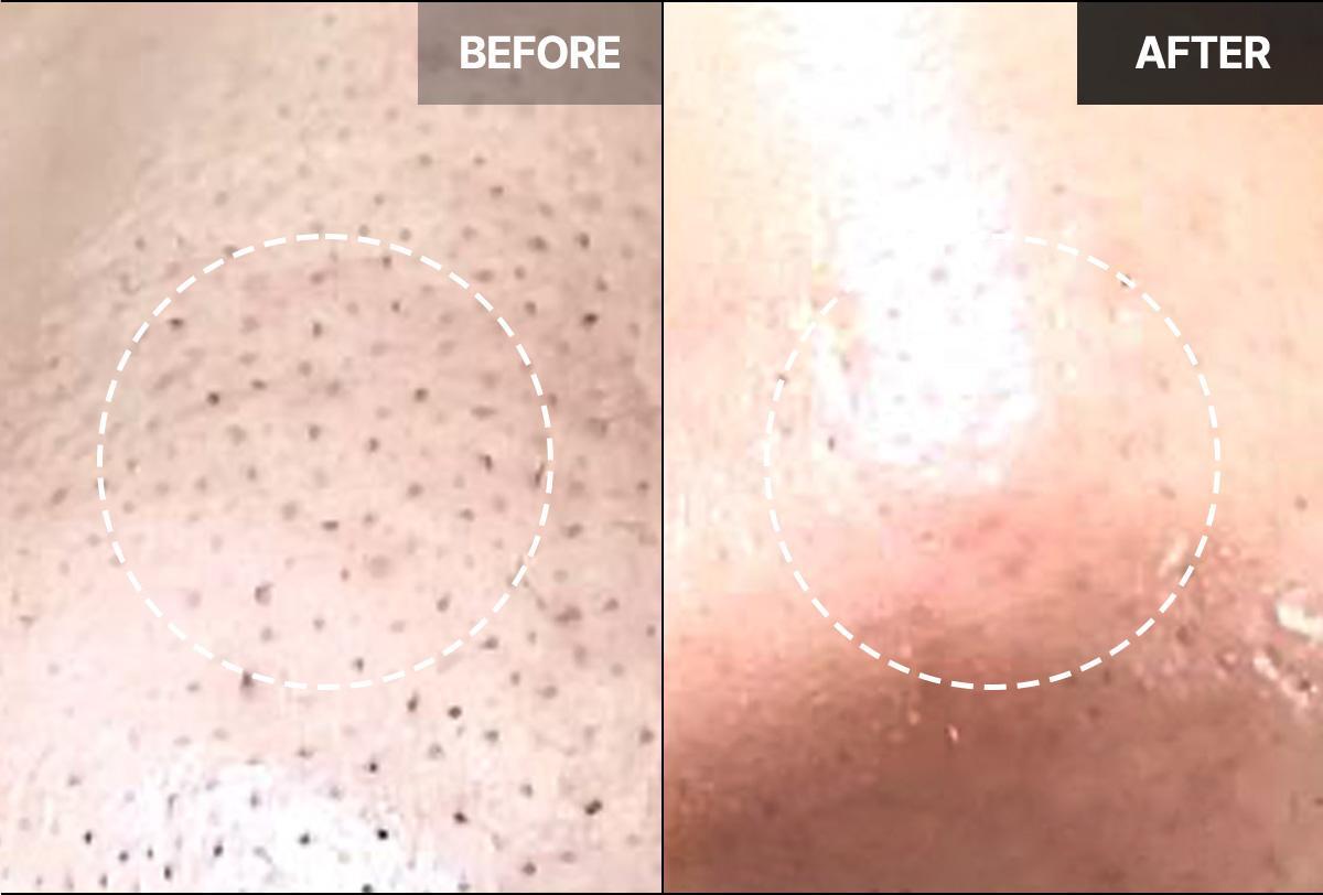 韓國 April Skin Carrotene IPMP Hydromelt Cleansing Balm 胡蘿蔔IPMP深層潔淨卸妝霜