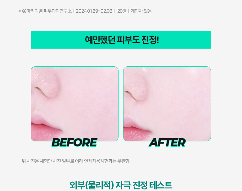 \ 24年更新版 / 韓國 Olive Young🏆 Bring Green Tea Tree Cica Soothing Toner 茶樹積雪草舒緩爽膚水 (250ml / 500ml) - 2種選擇