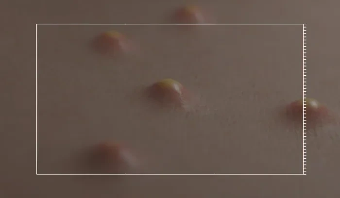 痘痘肌~韓國 medicube Exosome Cica Calming Pad 第4代高效能積雪草舒緩爽膚棉片 - 100片裝