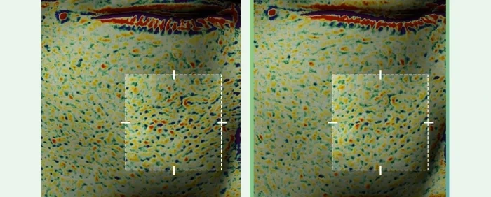 痘痘肌~韓國 medicube Exosome Cica Calming Pad 第4代高效能積雪草舒緩爽膚棉片 - 100片裝
