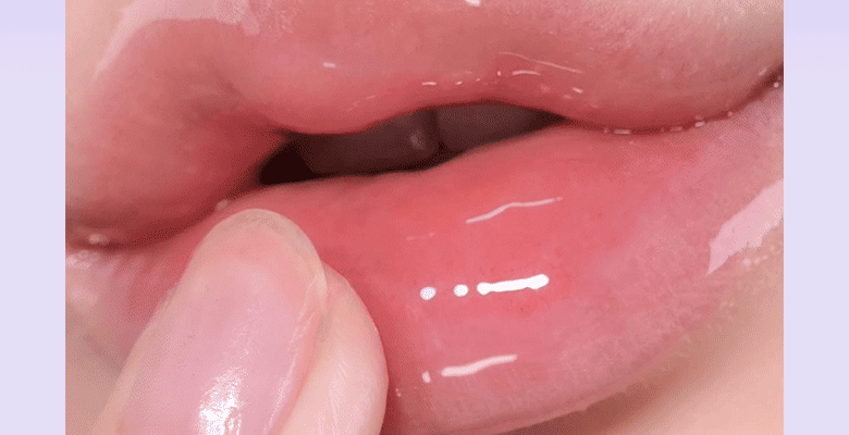 【附送矽膠唇刮】為雙唇注滿水~韓國 BIOHEAL BOH Probioderm™ Collagen Volume Lip Balm 益生菌膠原蛋白豐盈修護水潤唇膜