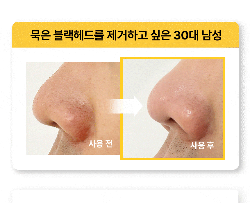 \LEOJ 大推！一次見效 / 韓國 The Tool Lab Honey Finger Glove For Pore 深清去角質收毛孔泡泡潔面手套 1盒4片裝